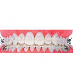 BRACKETS BRILLIANT ROTH 018 KIT