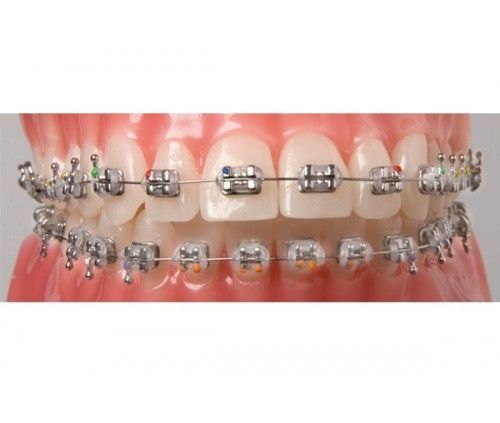 BRACKETS AGILE ROTH 018 5-5 SUPERIOR/INFERIOR