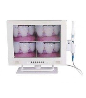 CÁMARA INTRAORAL Y MONITOR